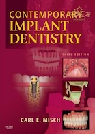 Contemporary Implant Dentistry
