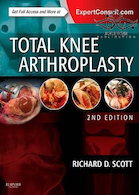 Total Knee Arthroplasty, 2nd Edition2014 آرتروپلاستی کامل زانو