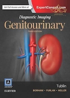 Diagnostic Imaging: Genitourinary
