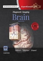 Diagnostic Imaging: Brain