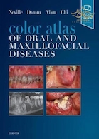 Color Atlas of Oral and Maxillofacial Diseases
