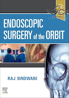Endoscopic Surgery of the Orbit 1st Edition