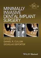 Minimally Invasive Dental Implant Surgery | جراحی ایمپلنت دندان با حداقل تهاجم