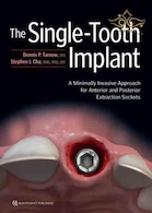 The Single-Tooth Implant: A Minimally Invasive Approach for Anterior and Posterior Extraction Sockets 1st Edition 2020 | ایمپلنت تک دندان: یک رویکرد حداقل تهاجمی برای سوکت های استخراج قدامی و خلفی