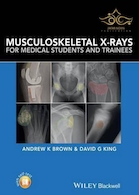 Musculoskeletal X-Rays for Medical Students and Trainees | اشعه ایکس عضلانی اسکلتی برای دانشجویان و کارآموزان پزشکی