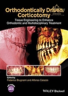 Orthodontically Driven Corticotomy