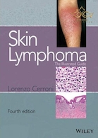 Skin Lymphoma : The Illustrated Guide