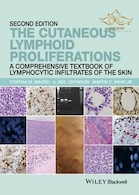 The Cutaneous Lymphoid Proliferations 