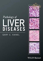 Pathology of Liver Diseases