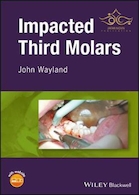 2018 Impacted Third Molars 1st Edition | تأثیرگذار بر مولر