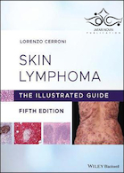 Skin Lymphoma The Illustrated Guide 5th Edition 2020