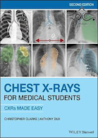 Chest X-Rays for Medical Students: CXRs Made Easy 2nd Edition2020 | اشعه ایکس قفسه سینه برای دانشجوی پزشکی