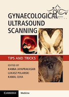 Gynaecological Ultrasound Scanning: Tips and Tricks 1st Edition 2020