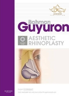 Rhinoplasty