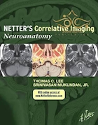 Netter's Correlative Imaging: Neuroanatomy : with NetterReference.com Access
