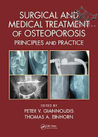 Surgical and Medical Treatment of Osteoporosis: Principles and Practice 1st Edition درمان جراحی و پزشکی پوکی استخوان: اصول و عمل