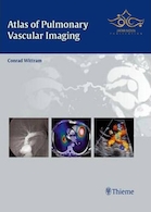 Atlas of Pulmonary Vascular Imaging