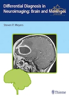 Differential Diagnosis in Neuroimaging: Brain and Meninges