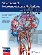 Video Atlas of Neuroendovascular Procedures 1st Edition2020 اطلس ویدئویی روشهای عصبی
