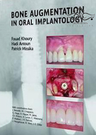Bone Augmentation in Oral Implantology2007 افزایش استخوان در ایمپلنتولوژی دهان