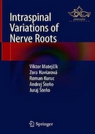 Intraspinal Variations of Nerve Roots
