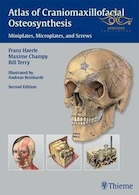 Atlas of Craniomaxillofacial Osteosynthesis : Microplates, Miniplates,and Screws