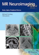 MR Neuroimaging : Brain, Spine, and Peripheral Nerves