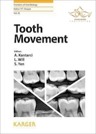 Tooth Movement