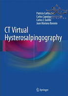 CT Virtual Hysterosalpingography2014 CT هیستروسالپنگوگرافی مجازی