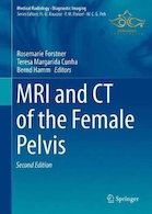 MRI and CT of the Female Pelvis