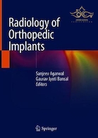 Radiology of Orthopedic Implants
