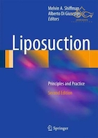 Liposuction : Principles and Practice