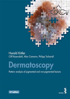 Dermatoscopy: Pattern analysis of pigmented and non-pigmented lesions | درماتوسکوپی: تجزیه و تحلیل الگوی ضایعات رنگدانه دار و غیر رنگدانه دار