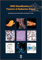 WHO Classification of Tumours of Endocrine Organs, 4th Edition2017 طبقه بندی تومورهای اندام های غدد درون ریز