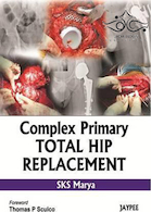 Complex Primary Total Hip Replacement 1st Edition | جایگزینی کامل کامل هیپ اولیه