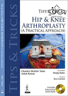 Tips and Tricks in Hip and Knee Arthroplasty2014 نکات و نکاتی در آرتروپلاستی مفصل ران و زانو