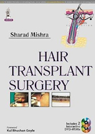 Hair Transplant Surgery 1st Edition 2014 | جراحی کاشت مو