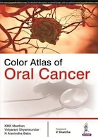Color Atlas of Oral Cancer