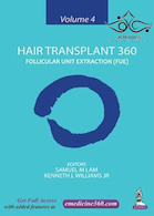 Hair Transplant 360: Follicular Unit Extraction (FUE)2019 | کاشت مو 360: استخراج واحد فولیکولی
