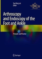 Arthroscopy and Endoscopy of the Foot and Ankle : Principle and Practice