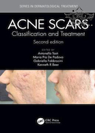 Acne Scars: Classification and Treatment, 2nd Edition | درمان اسکار آکنه 2018