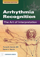 Arrhythmia Recognition: The Art of Interpretation 2nd Edition2019 تشخیص آریتمی