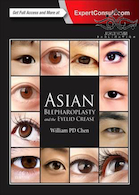 Asian Blepharoplasty and the Eyelid Crease 3rd Edition | بلفاروپلاستی آسیایی و چین پلک 2015