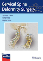 Cervical Spine Deformity Surgery2019 جراحی تغییر شکل ستون فقرات گردنی