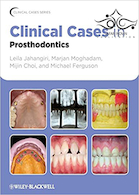 Clinical Cases in Prosthodontics 1st Edition2010 موارد بالینی در پروتزهای دندانی