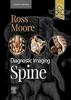 Diagnostic Imaging: Spine2021 تصویربرداری تشخیصی: ستون فقرات