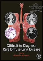 Difficult to Diagnose Rare Diffuse Lung Disease2019 تشخیص بیماری نادر ریوی