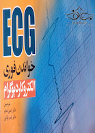 ECG خواندن فوری الکتروکاردیوگرام