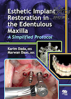 Esthetic Implant Restoration in the Edentulous Maxilla2014 ترمیم ایمپلنت زیبایی در فک بالا