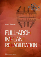 Full-Arch Implant Rehabilitation 1st Edition2019 توان بخشی کامل کاشت
